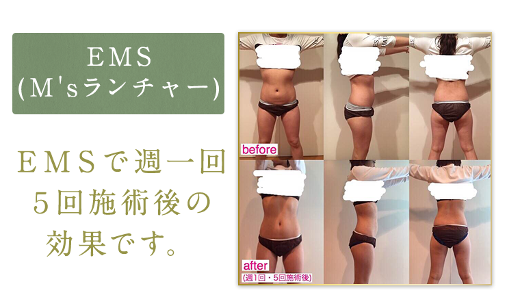 ＥＭＳ